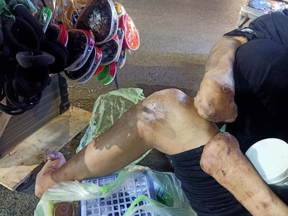 Bé gái xinh như thiên thần cùng bà tật nguyền mưu sinh trong đêm Đà Lạt gây sốt MXH, khiến dân mạng tranh cãi gay gắt-3