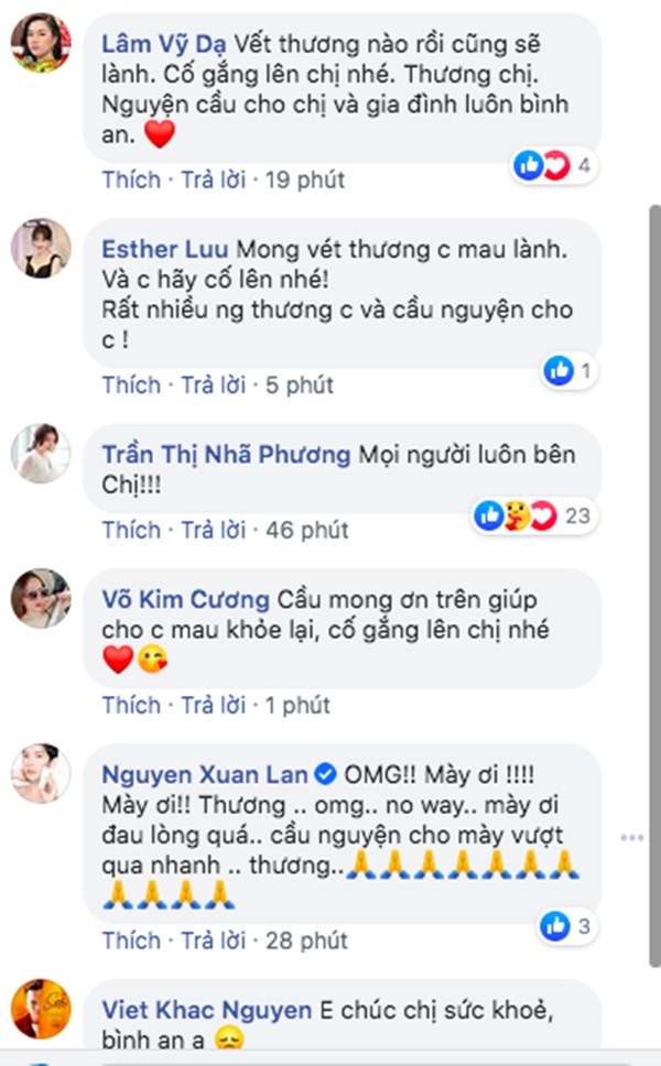 Ca sĩ Hồng Ngọc bất ngờ công khai ảnh bị bỏng 2/3 gương mặt-3