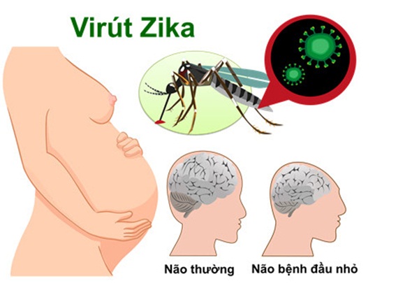 Phát hiện 1 nam thanh niên ở Đà Nẵng mắc virus Zika: Bệnh Zika nguy hiểm ra sao và lây qua những con đường nào?-2