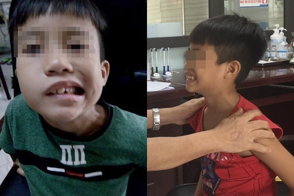 Không muốn liệt mặt, đột tử trong mùa hè thì cả gia đình cần bỏ ngay 5 thói quen dùng điều hòa nguy hại này-1