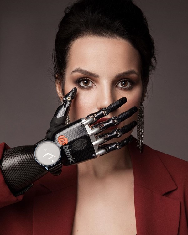 Chồng đã chặt tay tôi - tiếng kêu xé lòng và câu chuyện của người vợ xinh đẹp rơi vào bi kịch vì thói ghen tuông mù quáng của chồng-6