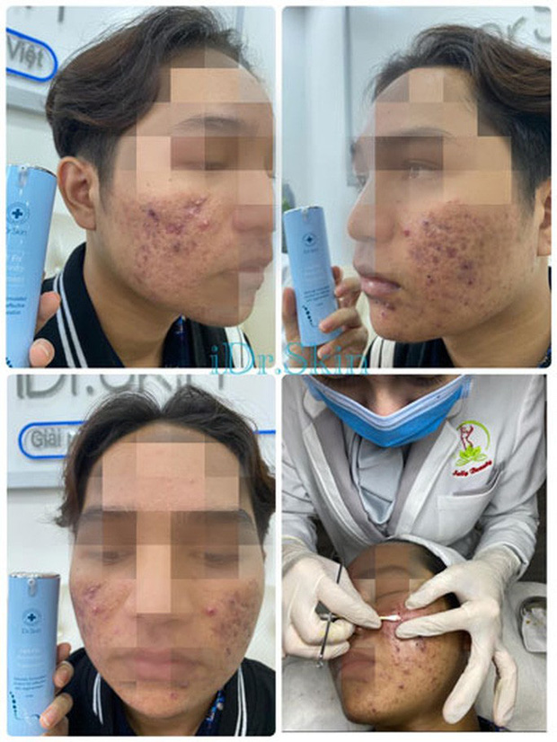 SỰ THẬT ĐÁNG SỢ TRONG THẾ GIỚI KEM TRỘN”: Kinh hãi và ám ảnh!-1