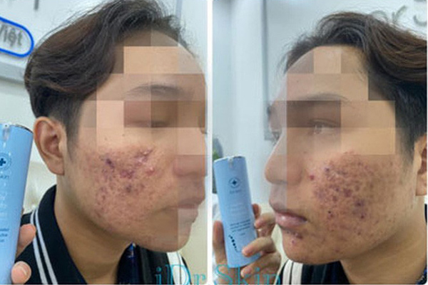 Dân buôn kem trộn tràn lên Tik Tok với những chiêu bài quảng cáo kinh dị-13