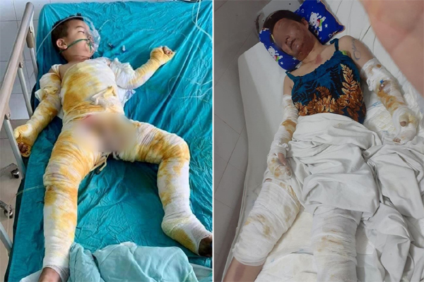 Một nhóm người ném bom xăng rồi ngăn không cho người dân chữa cháy, hai đứa trẻ bị bỏng nặng-5