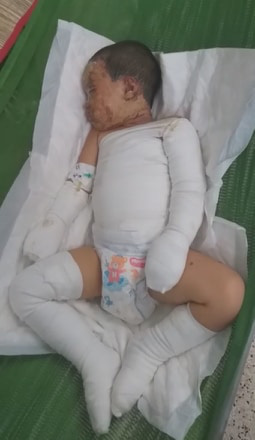 Một nhóm người ném bom xăng rồi ngăn không cho người dân chữa cháy, hai đứa trẻ bị bỏng nặng-4