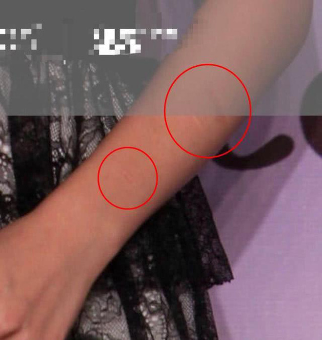 Xôn xao loạt hình ảnh Dương Mịch lộ sẹo dấy lên nghi vấn tự cắt cổ tay, ngược đãi bản thân-5