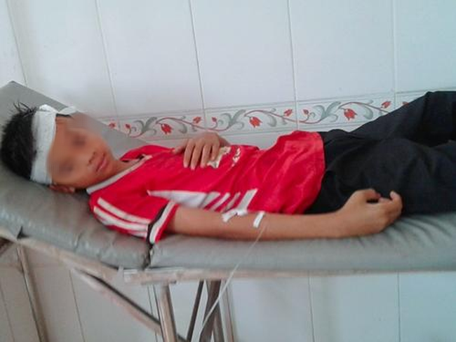 Giật mình với hàng loạt tai nạn học đường xuất phát từ những hiểm họa hiện hữu ngay trong trường lớp-7