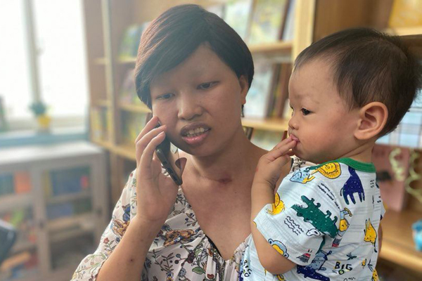 Mẹ con Bình An sau 1 năm thực hiện ca mổ ngồi bắt thai-1