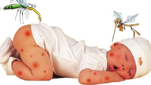 Bắt đầu vào mùa viêm não Nhật Bản, cha mẹ cần phân biệt triệu chứng sốt do viêm não Nhật Bản và bệnh lý khác để phòng bệnh cho con-1