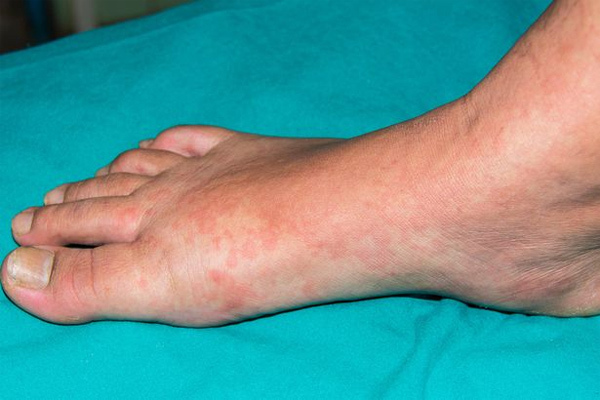 Màu da thay đổi hé lộ nhiều bệnh nguy hiểm-3