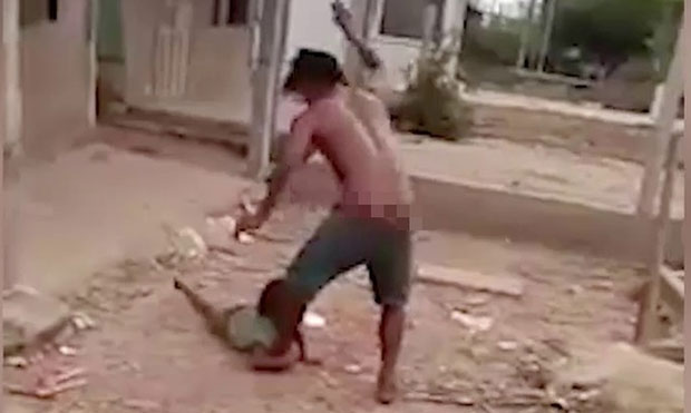 Diễn biến sức khỏe bé gái 6 tuổi bị cha đánh, giẫm đạp dã man-3