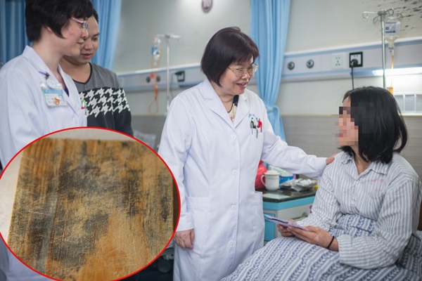 Cơ thể xuất hiện 1 đỏ, 2 vàng, 1 đen: Dấu hiệu mắc ung thư gan-4