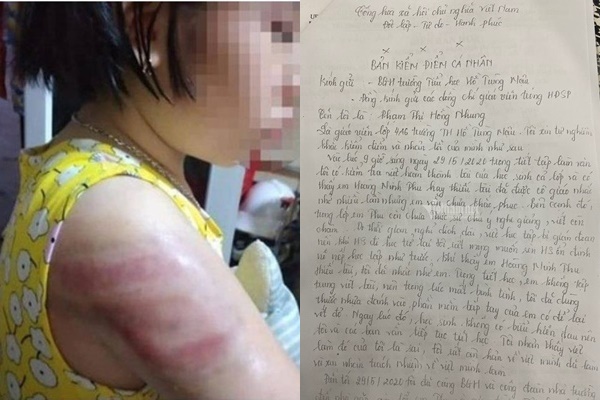 Xôn xao thông tin bé trai tiểu học bị phụ huynh cùng lớp bắt cóc ra ngoài, đánh chảy máu miệng vì trót giật mũ của bạn-4