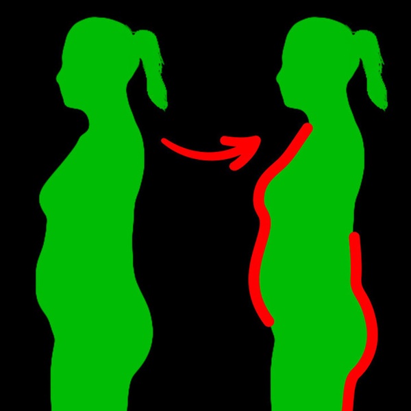 Nếu bạn bỗng tăng cân đột ngột chỉ trong 1 - 2 ngày, đây có thể là 4 nguyên nhân mà bạn chẳng ngờ đến-2