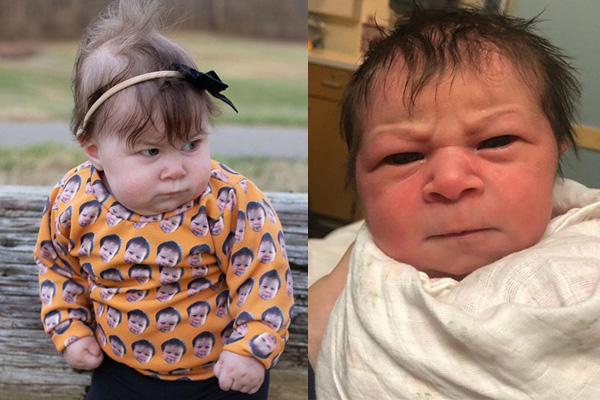 Em bé bong bóng: Cuộc đời 12 năm của đứa trẻ mắc căn bệnh quái ác bẩm sinh, ra đi với tương tác duy nhất trong đời là nụ hôn của mẹ-9