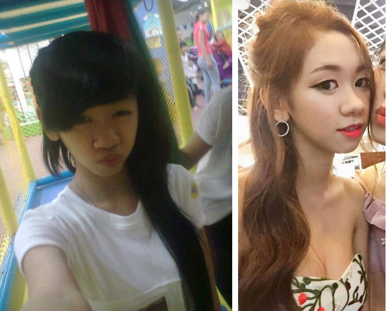 Bị bạn trai chê ngoại hình xấu, cô gái được mẹ tháp tùng đi phẫu thuật thẩm mỹ, hiện tại xinh đẹp đến mức ai nhìn cũng muốn yêu-1