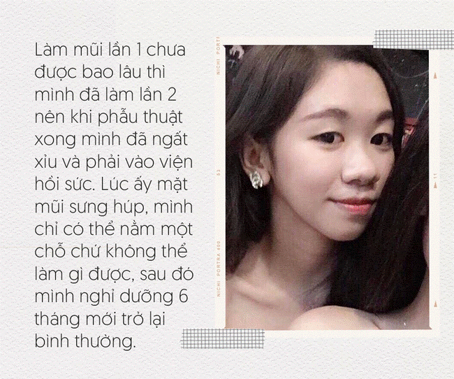 Bị bạn trai chê ngoại hình xấu, cô gái được mẹ tháp tùng đi phẫu thuật thẩm mỹ, hiện tại xinh đẹp đến mức ai nhìn cũng muốn yêu-4