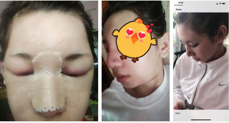 Bị bạn trai chê ngoại hình xấu, cô gái được mẹ tháp tùng đi phẫu thuật thẩm mỹ, hiện tại xinh đẹp đến mức ai nhìn cũng muốn yêu-3