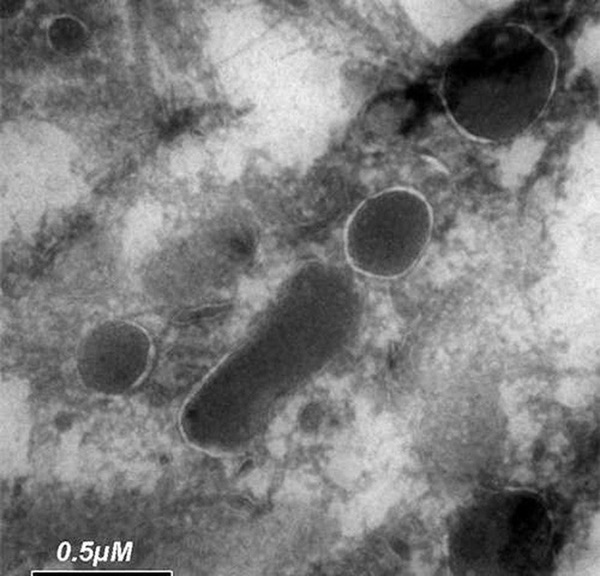 Phát hiện rùng mình về sinh vật sống trong tế bào ung thư-1