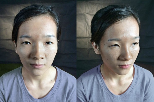 Cô gái dân tộc từng bị miệt thị bởi ti hí mắt lươn sau 3 năm dao kéo đổi đời: Ngày càng xinh đẹp như búp bê, vừa kết hôn với chồng bác sĩ-1