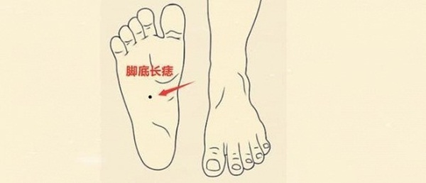 5 nốt ruồi giàu có trên cơ thể dự báo tương lai phú quý, cả đời ăn sung mặc sướng-3