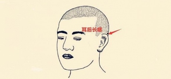 5 nốt ruồi giàu có trên cơ thể dự báo tương lai phú quý, cả đời ăn sung mặc sướng-5