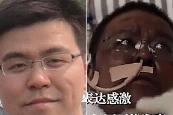 4 món ăn được vạn người mê nhưng lại dễ gây nguy cơ chết người, đặc biệt là món số 2-7