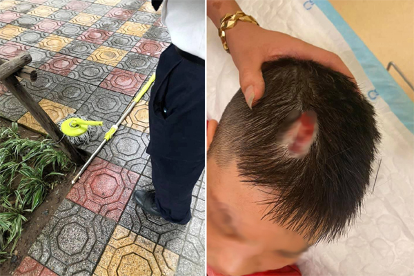 Thông tin mới nhất tình hình 2 học sinh bị cây phượng tại trường THCS Bạch Đằng đè chấn thương nặng-2