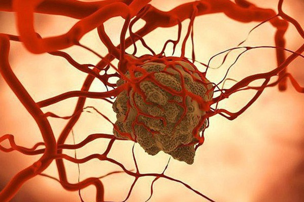 WHO chỉ ra những món ăn có tác dụng phòng ngừa bệnh ung thư một cách vượt trội, tất cả đều ngon lành, rẻ tiền và đặc biệt có bán ở khắp các chợ!-5