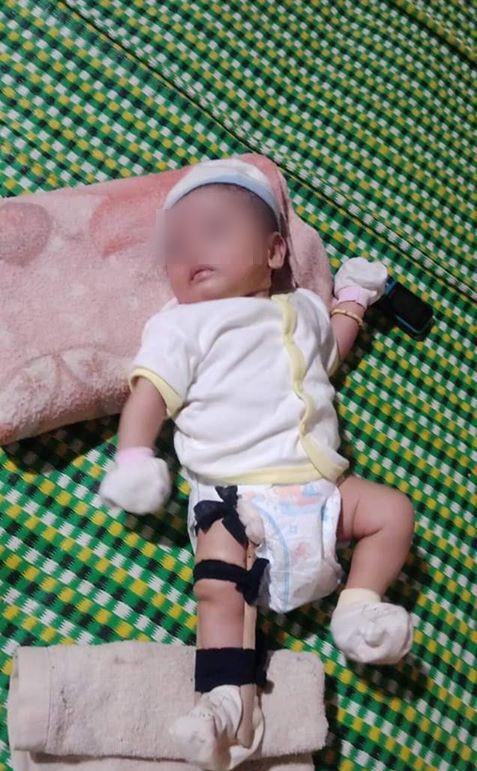 Sự thật vụ bé 2 tháng tuổi nghi bị cha ruột bạo hành tới gãy chân ở Bình Phước-1