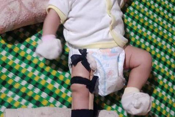 Điều tra vụ người phụ nữ nghi bị chồng hờ bạo hành dã man-2