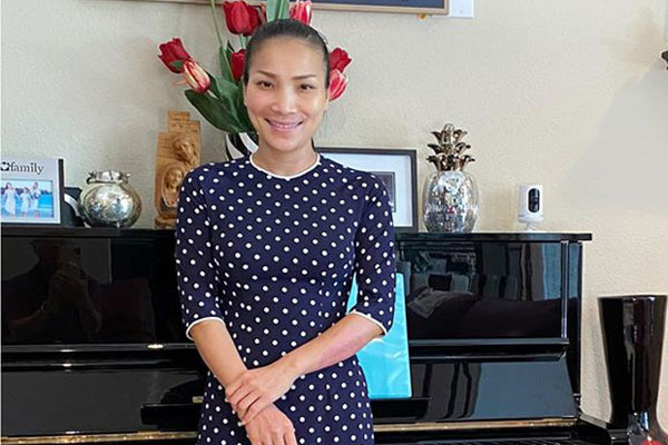 Gương mặt bỏng nặng của Hồng Ngọc hồi phục với tốc độ đáng kinh ngạc sau tai nạn nổ nồi xông hơi-3