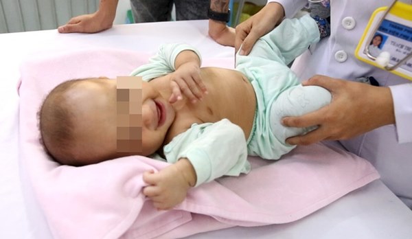 Bác sĩ Cần Thơ kịp thời phát hiện 1 trẻ sơ sinh mắc phải căn bệnh nếu chẩn đoán chậm trẻ sẽ vĩnh viễn bị thiểu năng trí tuệ-1