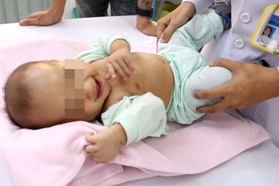 Bác sĩ Cần Thơ kịp thời phát hiện 1 trẻ sơ sinh mắc phải căn bệnh nếu chẩn đoán chậm trẻ sẽ vĩnh viễn bị thiểu năng trí tuệ