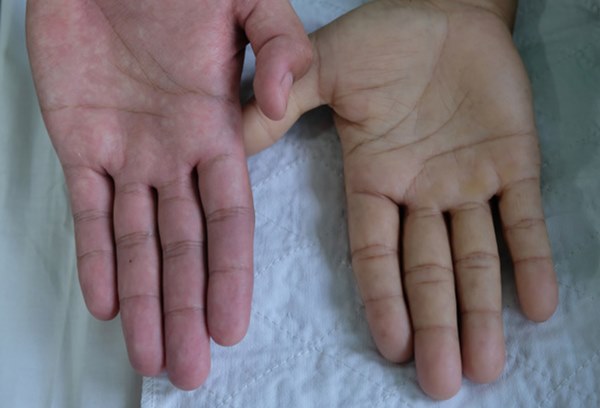 Dù là nam hay nữ, chỉ cần nhìn vào 4 vị trí này trên cơ thể sẽ biết được mình có sống thọ hay không-2