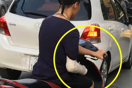 Xôn xao hình ảnh nam thanh niên bị gãy tay phải, vẫn liều mình vặn ga xe máy bằng... tay trái