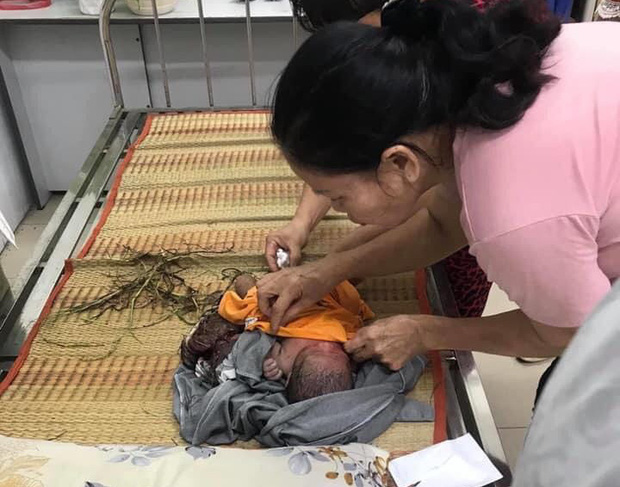 Bình Dương: Một bé sơ sinh còn nguyên dây rốn bị bỏ rơi ngoài bãi cỏ-1