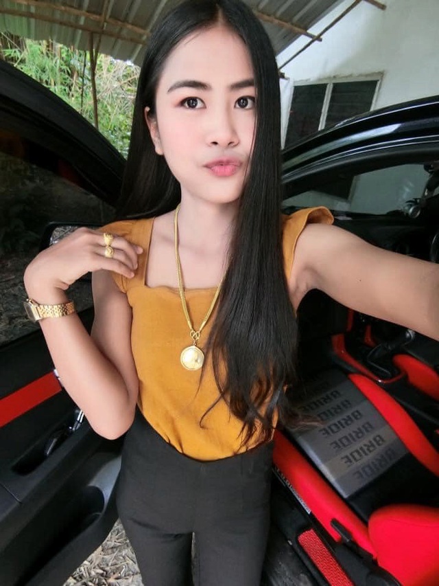 Sốc với hình ảnh cô gái bị dị ứng toàn thân, mặt biến dạng do dùng thuốc chữa đau răng khiến nhiều người thấy sợ-1