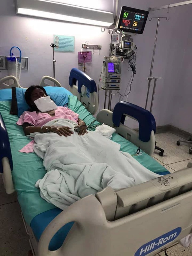 Sốc với hình ảnh cô gái bị dị ứng toàn thân, mặt biến dạng do dùng thuốc chữa đau răng khiến nhiều người thấy sợ-5