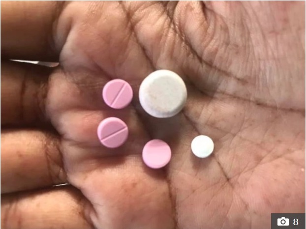 Sốc với hình ảnh cô gái bị dị ứng toàn thân, mặt biến dạng do dùng thuốc chữa đau răng khiến nhiều người thấy sợ-6