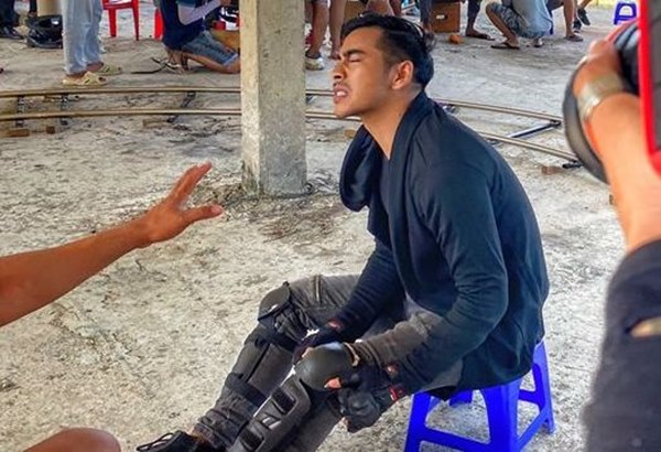Diễn viên Thanh Bình bị vỡ sụn gối, chảy máu mắt trên phim trường-1