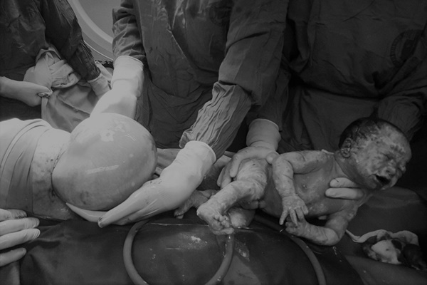 Hy hữu: Hai anh em sinh đôi chào đời cách nhau 10 năm, có nhiều điểm giống nhau đến ngỡ ngàng-6