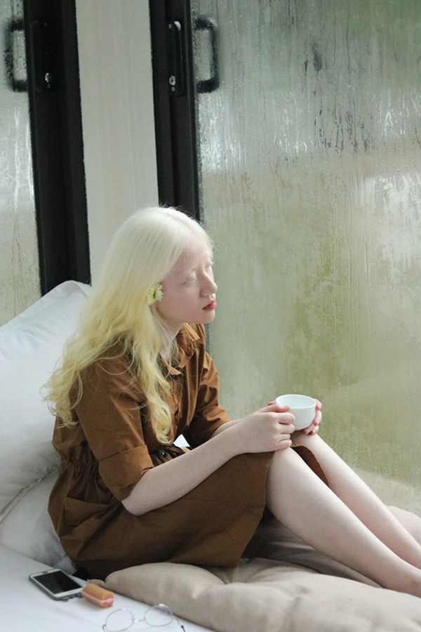 Nữ sinh bạch tạng gây bão với loạt ảnh xinh xuất thần như công chúa tuyết-5