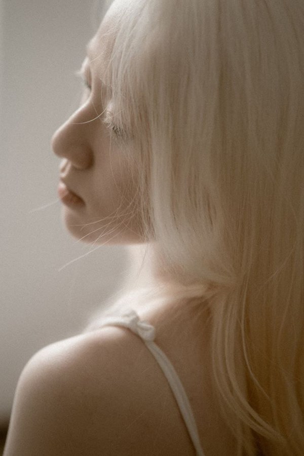 Nữ sinh bạch tạng gây bão với loạt ảnh xinh xuất thần như công chúa tuyết-7