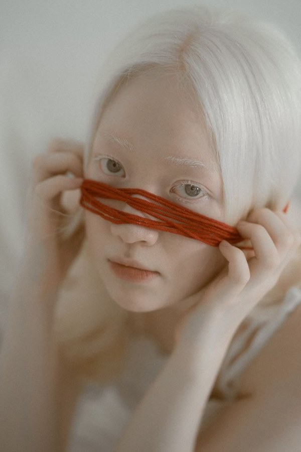 Nữ sinh bạch tạng gây bão với loạt ảnh xinh xuất thần như công chúa tuyết-8