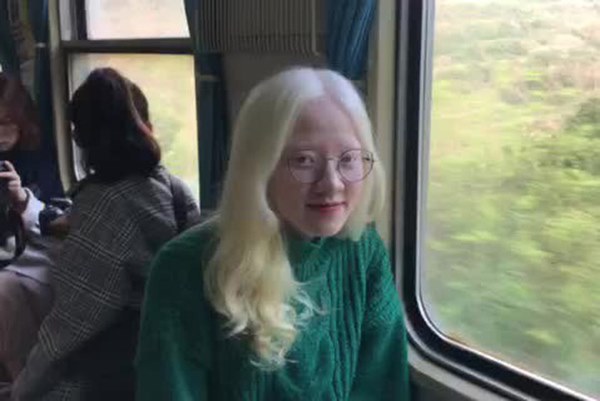 Nữ sinh bạch tạng gây bão với loạt ảnh xinh xuất thần như công chúa tuyết-9