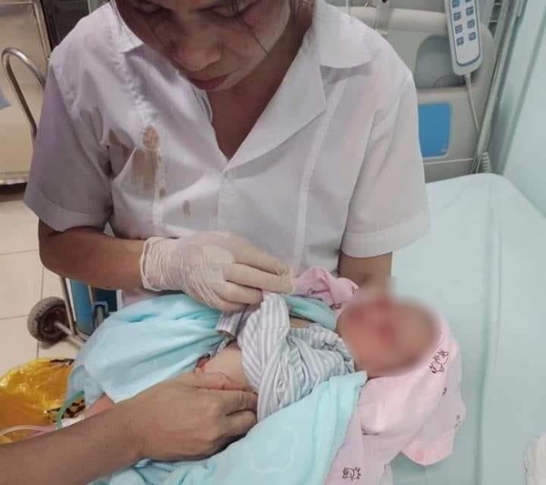 Bé sơ sinh bị bỏ dưới hố ga 3 ngày giữa nắng 40 độ, dòi bu đầy mặt-1