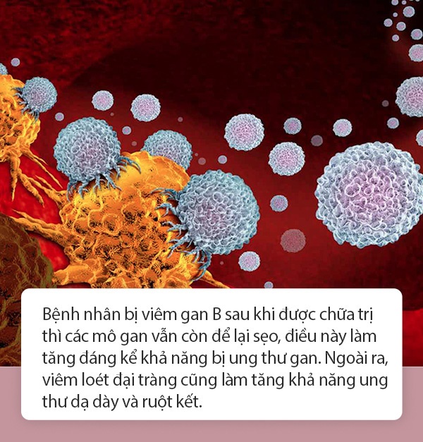 1/6 bệnh nhân ung thư có liên quan đến viêm: Nếu gặp tình trạng viêm ở 3 bộ phận này, tuyệt đối đừng chủ quan-1