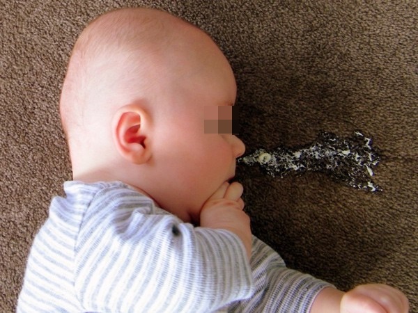 Bác sĩ Nhi: 6 biểu hiện có thể cảnh báo u não ở trẻ nhưng dễ nhầm sang bệnh vặt-2