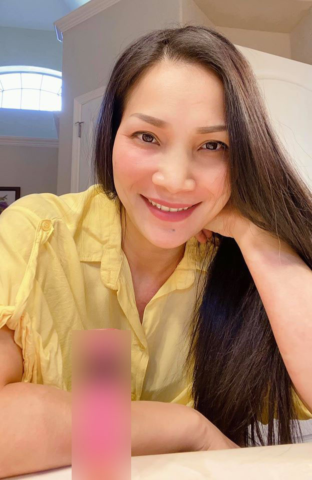 Gương mặt bỏng nặng của Hồng Ngọc hồi phục với tốc độ đáng kinh ngạc sau tai nạn nổ nồi xông hơi-1